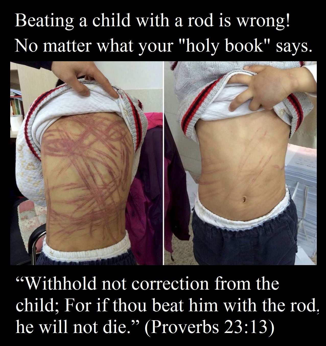“Withhold not correction from the child; For if thou beat him with the rod, he will not die.” (Proverbs 23:13)